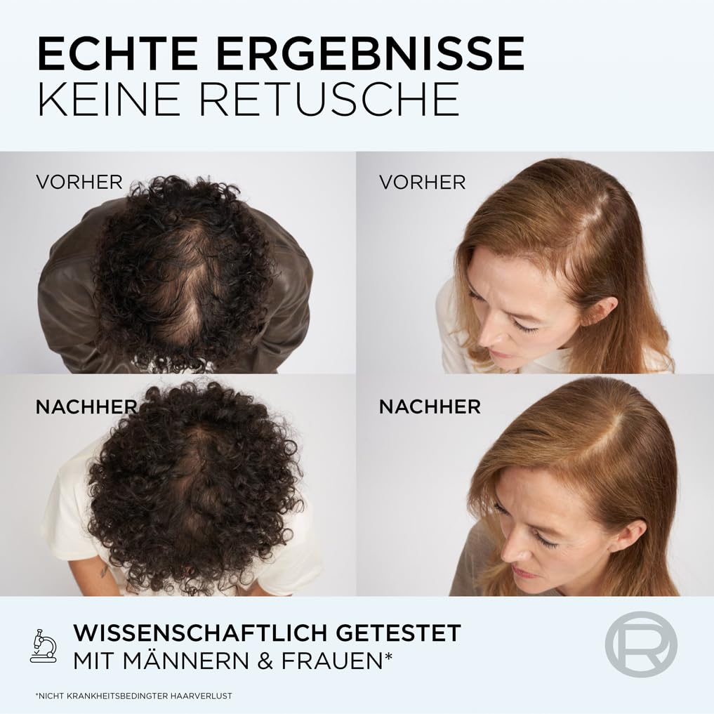 L'Oréal Paris Fiber Booster Anti-Haarverlust-Kopfhaut-Serum: Gegen Haarausfall (3x 102ml)