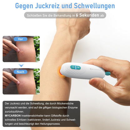 MYCARBON Insektenstichheiler: Hitzestift Behandlung von Juckreiz & Schmerz & Schwellungen